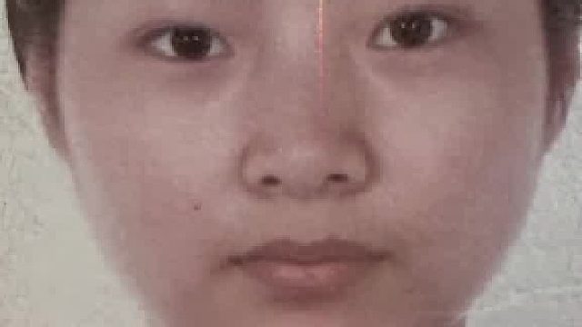 为了变好看在脸上花了一辆保时捷，从1.0到10.0完全没认出来