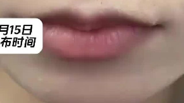 戴了一年的牙齿保持器，仅仅一周没戴就发现戴不上了，网友：这种保持器要戴一辈子吗