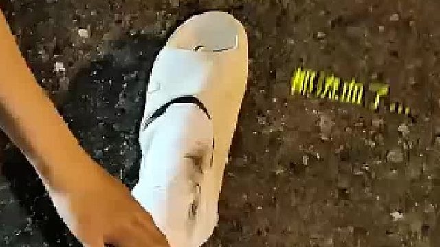 骨折出院女友来接 结果刚出院就被原路送回 网友：不开玩笑是我都想分手了