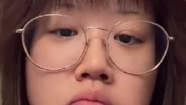 女子晒下巴上的肌肉图，感觉自己下巴上长了两个大海葵