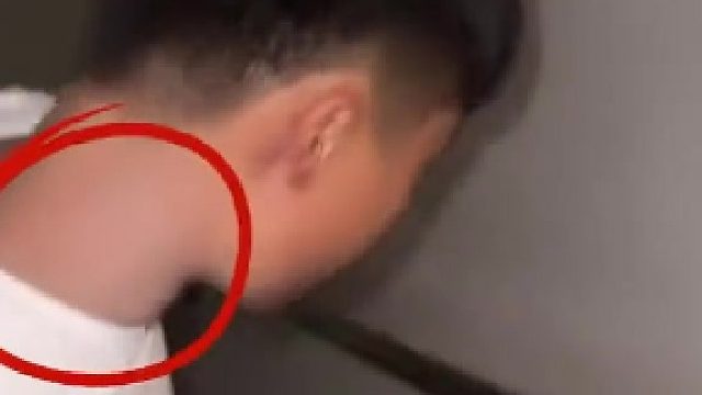 女子发现男朋友的脖子上有粉底液，洗澡后显露出来的是个草莓，女子：他说是因为我俩吵架他自己抓的