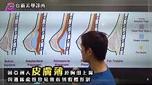 【科普医美新知】水滴果冻隆乳、自体脂肪隆乳哪一种适合我呢？ 「双层面复合式」新技术 成就宛若天生美胸