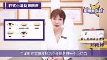 爱汇星：韩式小清新双眼皮科普