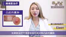 爱汇星：ELEEN炎症痘痘肌肤治疗科普