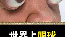 世界上眼球最突出的人，有点厉害啊#世界之最 #吉尼斯世界纪录