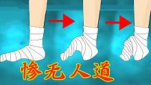 【科普】可怕的封建裹脚！10个脚指头伤8个，脚掌使劲向内折