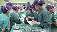 女子肩扛篮球大小的瘤子，手术医生戴五倍放大镜为其摘除肿瘤！