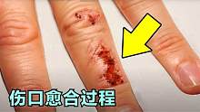 6件未知的神奇事件，受伤后伤口如何愈合？看修复全过程！