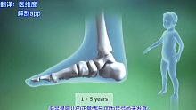 医学3D动画演示-什么是扁平足？它是如何形成的？有哪些危害？