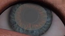 3D医学科普视频：白内障手术过程