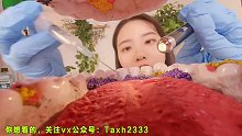 【3D解压】口腔内部的模拟清洁