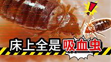 女孩身上反复起红疹，掀开床单：全是吸血虫！