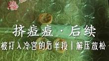 模拟·挤痘痘后续｜被打入冷宫的版本#声控 #解压 #挤痘痘 #掏耳朵 #助眠 #放松 #舒适 #治愈