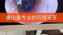 #可视采耳