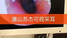#可视采耳