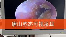#可视采耳 #强迫症必看 外耳道湿枕，耳道发霉，难不难受