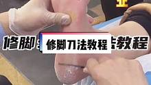 刮刀操作之脚底板彭世修脚，祖传六把刀之一❗看着过瘾不 #修脚 #灰指甲 #养生
