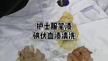 护士服笔油笔渍碘伏血渍清洗，还想看什么欢迎留言#竹洋洗涤 #护士服 #笔油 #血渍 