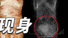 世界首具怀孕木乃伊现身，胎儿7个月大，S体也能“生”出孩子？(3/3)