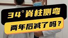 15岁女孩#脊柱侧弯 每天坚持佩戴#矫形支具 做#施罗斯矫形体操 两年后有改变吗？
