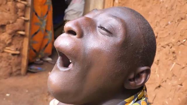 非洲夫妻产下3个小脑症患者,个个低能,父母血缘关系遭全村非议