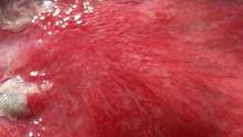 大海退潮后，大齐赶海发现八爪鱼油炸起来脆脆的，还有红色海锭 #赶海 