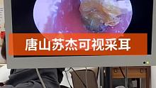 #可视采耳培训 #可视采耳