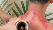 #肩颈疏通 #肩颈 #刮痧 操作简单，上手即会，赶紧行动起来吧