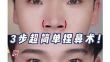 往鼻子里塞棉花，模拟蒜头鼻 | 山根塌，鼻翼大，鼻头圆的蒜头鼻！这期全方位教会你们，究竟怎么修鼻子！