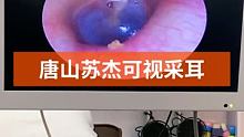 #可视采耳培训 #专业可视采耳 #可视采耳 鼓膜积液 耳漏 偶尔嗡嗡作响