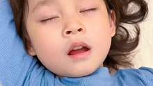 孩子张嘴睡觉要及时纠正，久了就会变丑，有了它就不怕啦#闭口贴  
