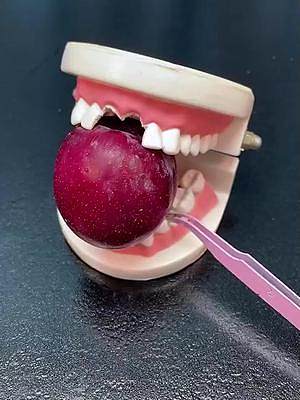 #補牙 #種牙  #牙齒健康  