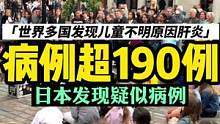 世界多国报告超190例儿童感染不明原因肝炎，日本发现首例疑似#小李哥在英国 #海外生活 #伦敦 #英