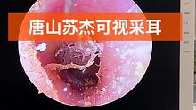 #可视采耳培训 #专业可视采耳 #专业采耳洗眼
