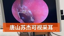 #可视采耳培训 #专业可视采耳 #专业采耳洗眼