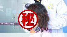 中医手法是可以缓解调理交感型颈椎病的#颈椎 #中医手法 