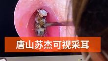 #可视采耳培训 #专业可视采耳 #专业采耳洗眼 勿忘心安