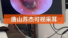 #可视采耳培训 #专业可视采耳 #专业采耳洗眼 来日并不方长，珍惜眼前哦