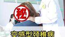 #交感型颈椎病 #中医手法 #颈椎 