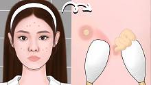 这波挤痘真的很像制作冰淇淋哎!|萌大佬美容室