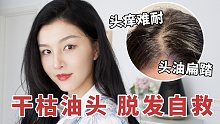 又痒又油？满头皮屑？一周让精致女孩摆脱大油头！