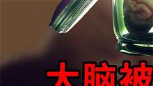 被切成240块后，科学家在爱因斯坦大脑发现啥？ 名人死后有多惨？ #爱因斯坦大脑 #大脑切片 #肖邦