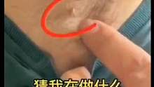 #小肉粒 #去除小肉粒#去除疣体#皮肤健康 #希望能帮到你 