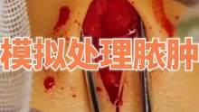 模拟处理伤口，视频中全程都是道具模型，非专业操作手法，请大家切勿模仿，如果哪里不舒服还是尽快就医，谨