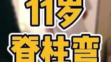 11岁，脊椎歪#脊柱侧弯 #圆肩驼背 #长短腿 #体态纠正 #驼背