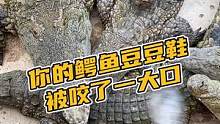 你的鳄鱼豆豆鞋被咬了一大口#鳄珍