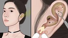 第一视角清理耳廓，这回是个大矿啊！极度舒适|萌大佬动画