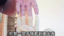 我的天，手皮都撕开了吗？