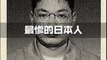 世界上最惨的日本人，被医生折磨了83天，看着自己的身体腐烂 #科普一下 #日本人 #核事故#2022