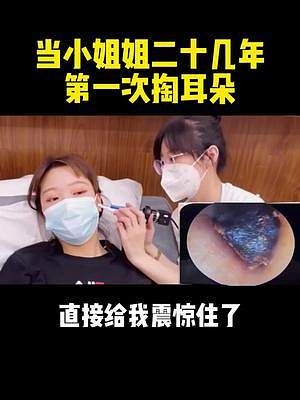 快把你家里的火柴都扔了吧，試試這個可視化掏耳勺，高清攝像+硅膠勺頭，給你超棒采耳體驗#掏耳朵 #掏耳